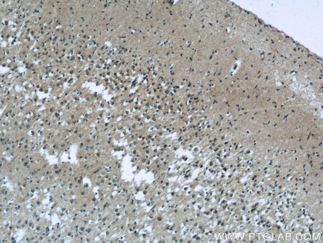 EXOC5 Antibody in Immunohistochemistry (Paraffin) (IHC (P))