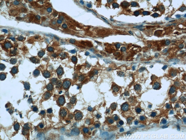 EXOC5 Antibody in Immunohistochemistry (Paraffin) (IHC (P))