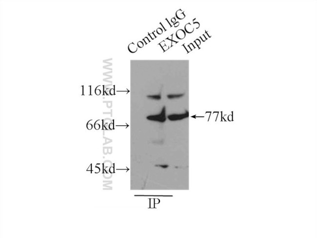 EXOC5 Antibody in Immunoprecipitation (IP)