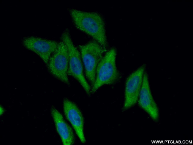 SMYD4 Antibody in Immunocytochemistry (ICC/IF)