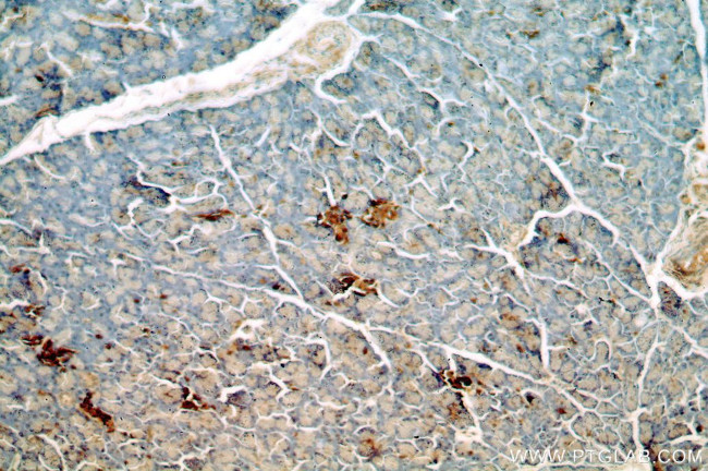 SMYD4 Antibody in Immunohistochemistry (Paraffin) (IHC (P))