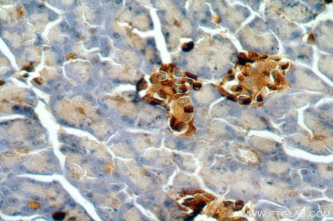 SMYD4 Antibody in Immunohistochemistry (Paraffin) (IHC (P))