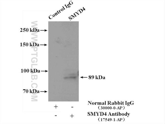 SMYD4 Antibody in Immunoprecipitation (IP)