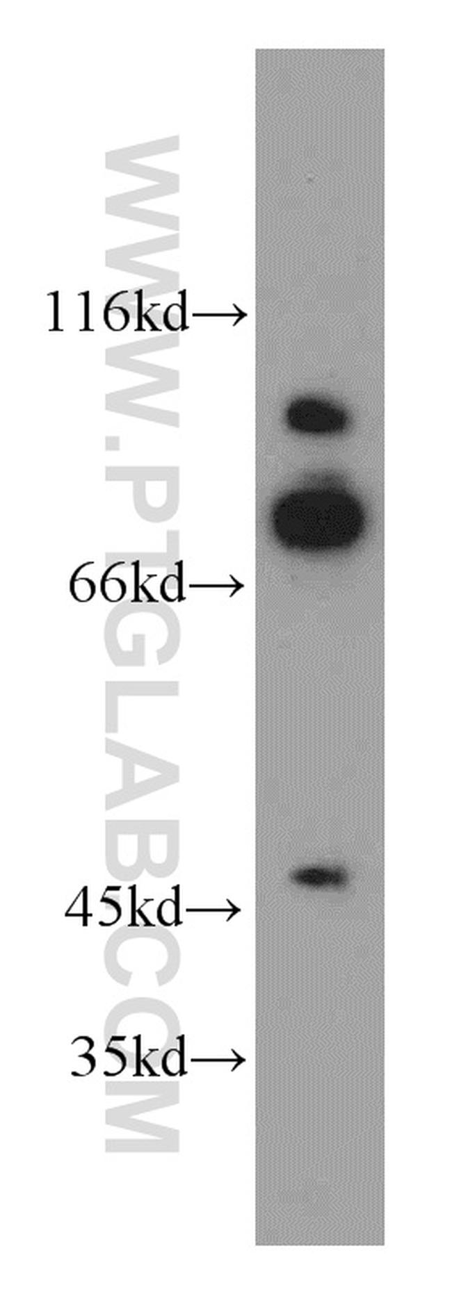 SMYD4 Antibody in Western Blot (WB)