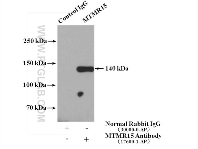 MTMR15 Antibody in Immunoprecipitation (IP)