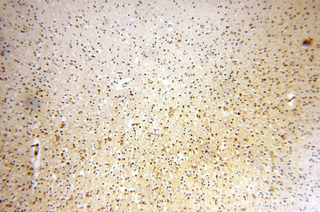 NDUFB2 Antibody in Immunohistochemistry (Paraffin) (IHC (P))