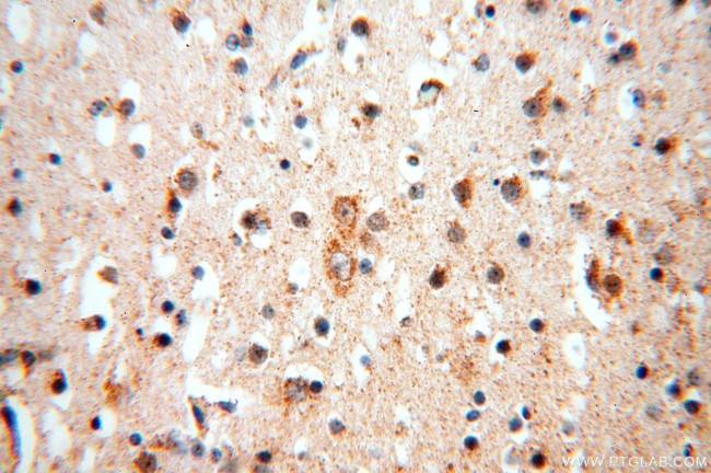 NDUFB2 Antibody in Immunohistochemistry (Paraffin) (IHC (P))