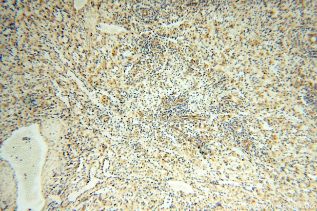 NDUFB2 Antibody in Immunohistochemistry (Paraffin) (IHC (P))