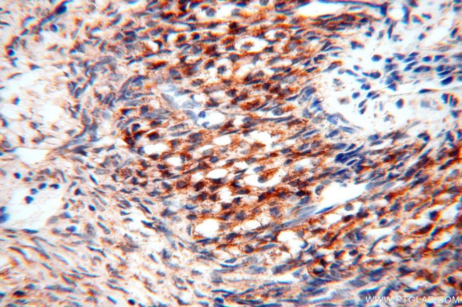 NDUFB2 Antibody in Immunohistochemistry (Paraffin) (IHC (P))