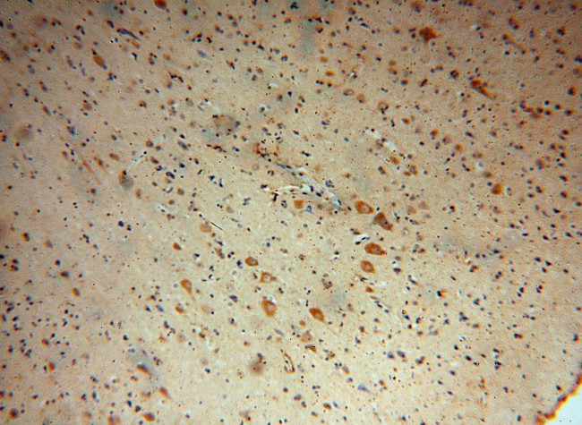 NDUFB2 Antibody in Immunohistochemistry (Paraffin) (IHC (P))