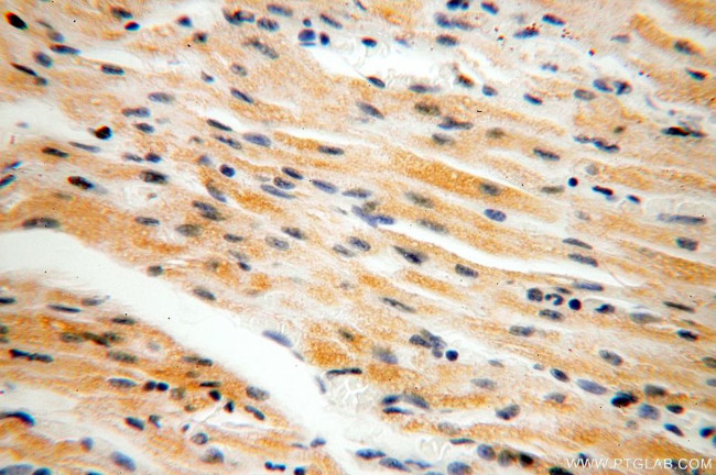 NDUFB2 Antibody in Immunohistochemistry (Paraffin) (IHC (P))