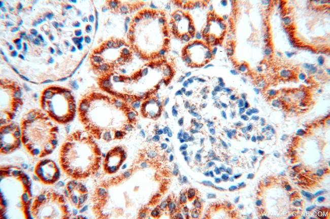 NDUFB2 Antibody in Immunohistochemistry (Paraffin) (IHC (P))