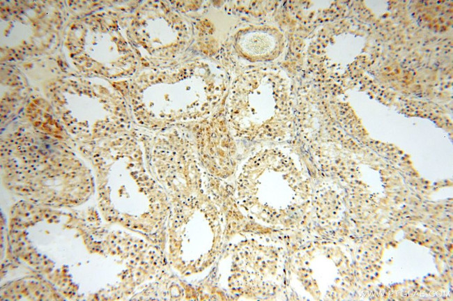 NDUFB2 Antibody in Immunohistochemistry (Paraffin) (IHC (P))