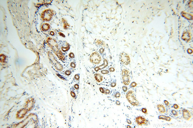 NDUFB2 Antibody in Immunohistochemistry (Paraffin) (IHC (P))