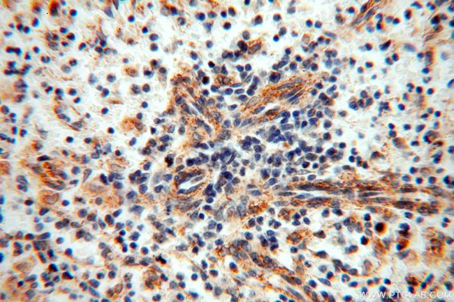 NDUFB2 Antibody in Immunohistochemistry (Paraffin) (IHC (P))