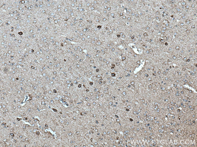 NDUFB2 Antibody in Immunohistochemistry (Paraffin) (IHC (P))