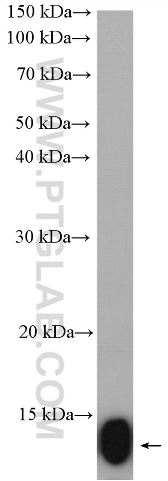 NDUFB2 Antibody in Western Blot (WB)