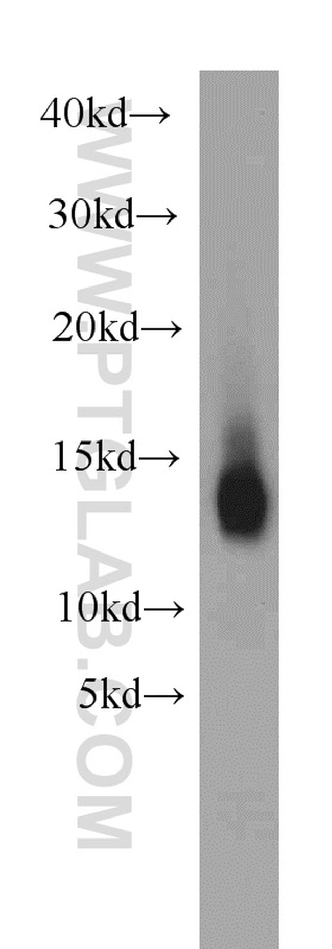 NDUFB2 Antibody in Western Blot (WB)