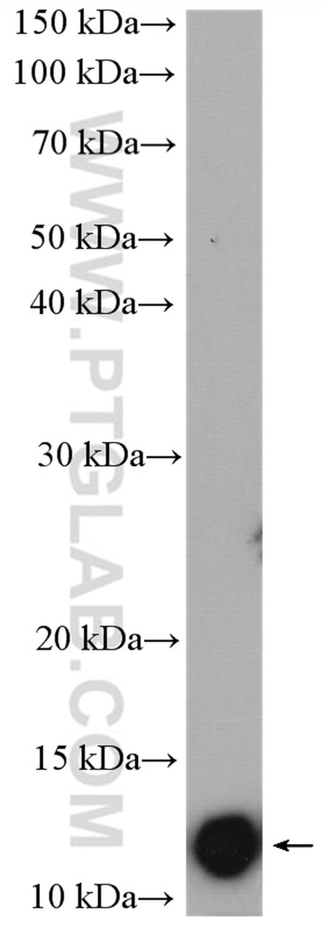 NDUFB2 Antibody in Western Blot (WB)