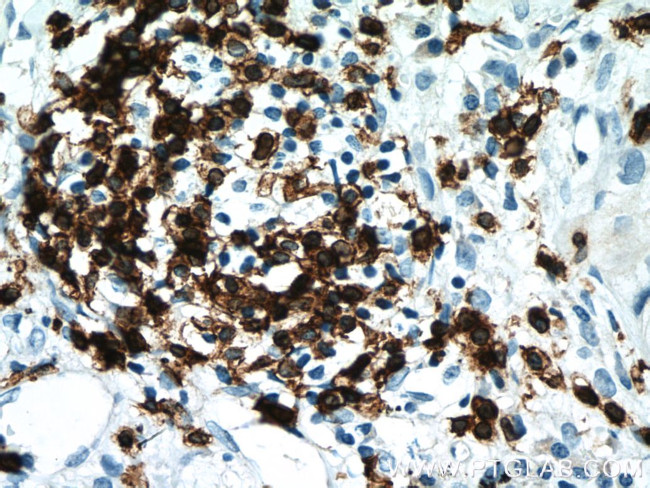 CD3 Antibody in Immunohistochemistry (Paraffin) (IHC (P))