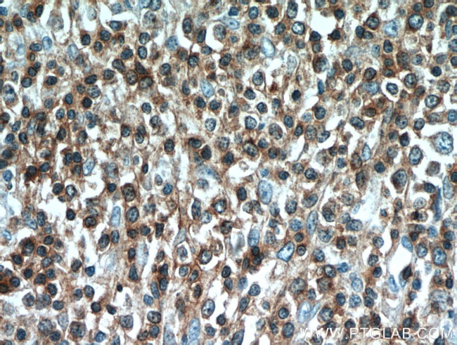 CD3 Antibody in Immunohistochemistry (Paraffin) (IHC (P))