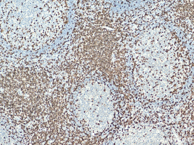 CD3 Antibody in Immunohistochemistry (Paraffin) (IHC (P))