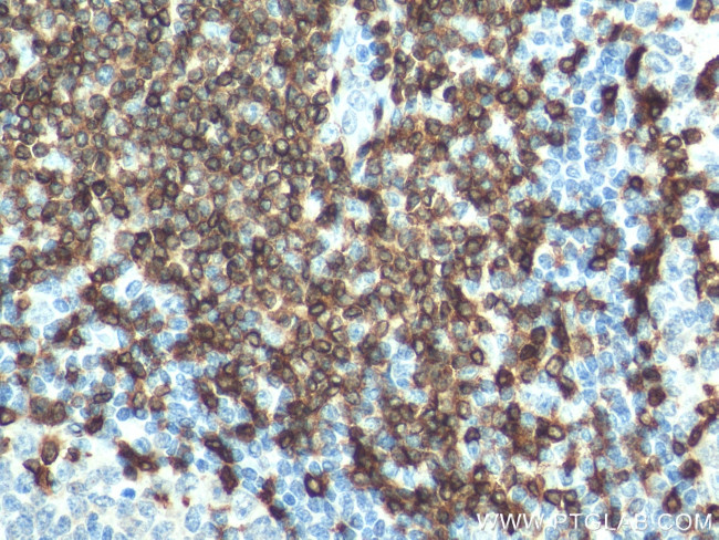 CD3 Antibody in Immunohistochemistry (Paraffin) (IHC (P))