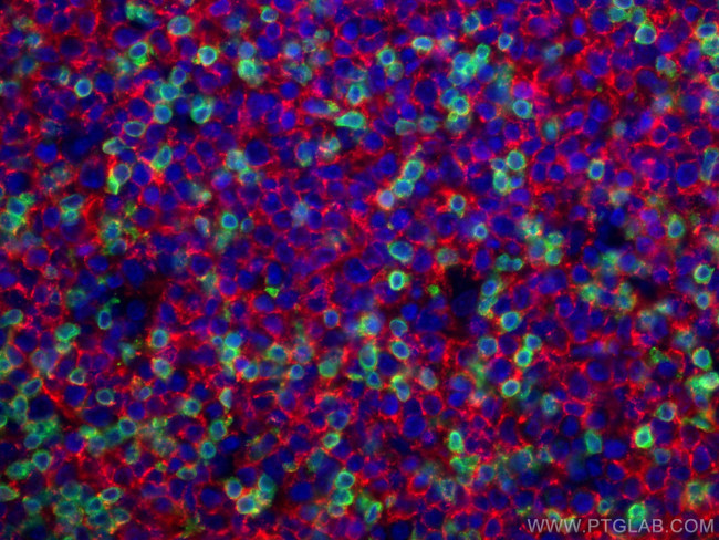 CD3 Antibody in Immunohistochemistry (PFA fixed) (IHC (PFA))