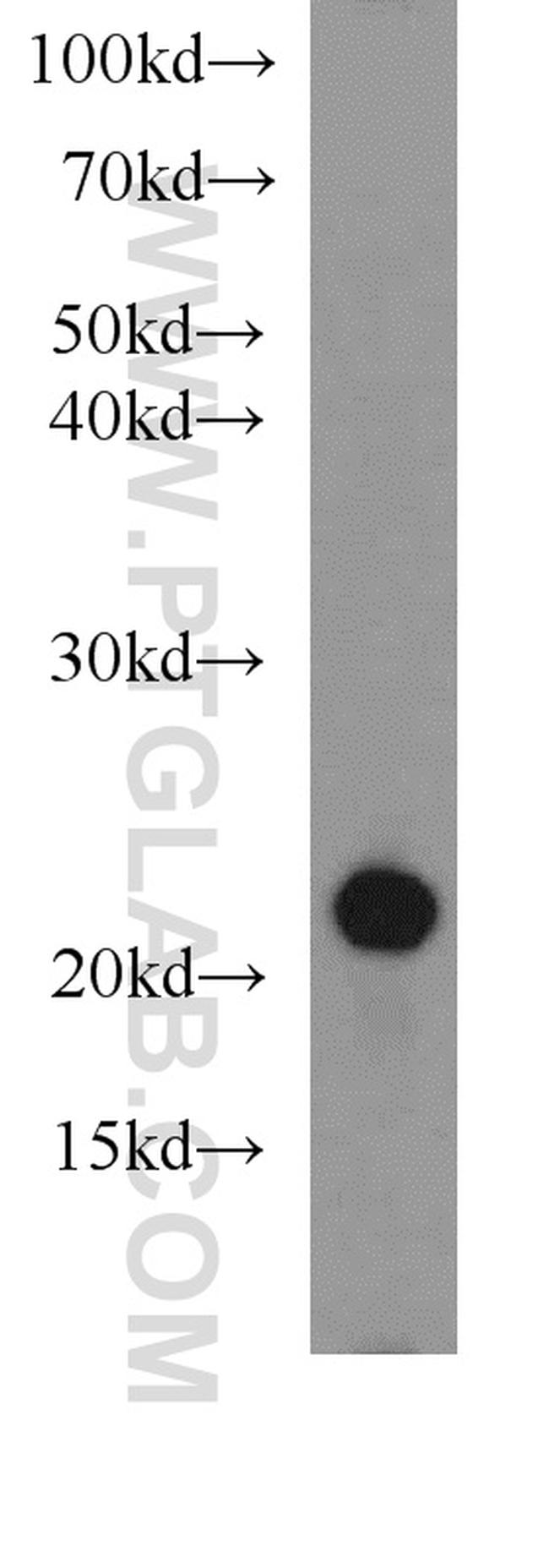 CD3 Antibody in Western Blot (WB)