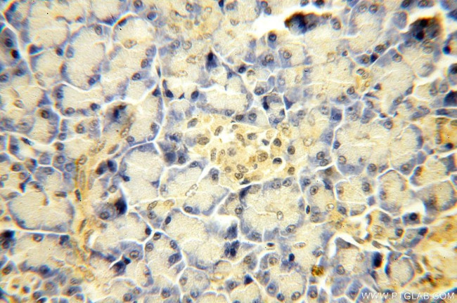 SBDS Antibody in Immunohistochemistry (Paraffin) (IHC (P))