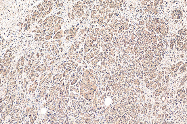 SBDS Antibody in Immunohistochemistry (Paraffin) (IHC (P))