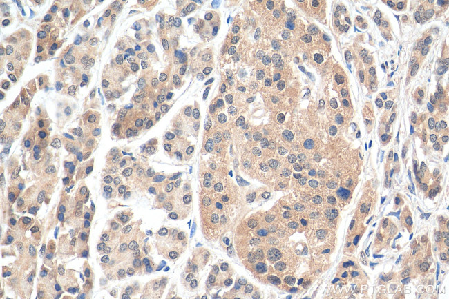 SBDS Antibody in Immunohistochemistry (Paraffin) (IHC (P))