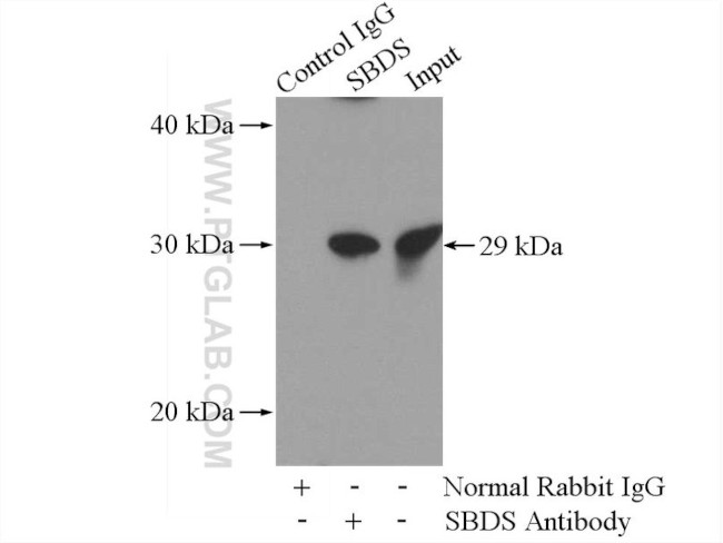 SBDS Antibody in Immunoprecipitation (IP)