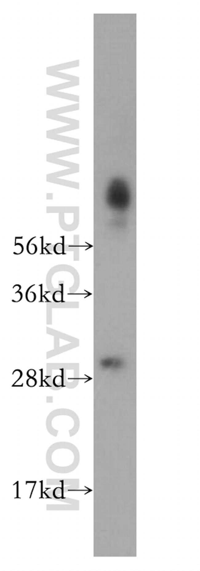 SBDS Antibody in Western Blot (WB)