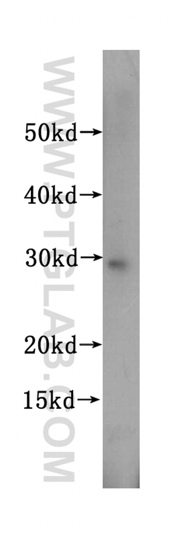 SBDS Antibody in Western Blot (WB)