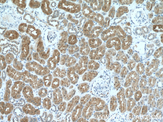 MIOX Antibody in Immunohistochemistry (Paraffin) (IHC (P))