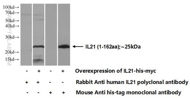 IL21 Antibody in Western Blot (WB)