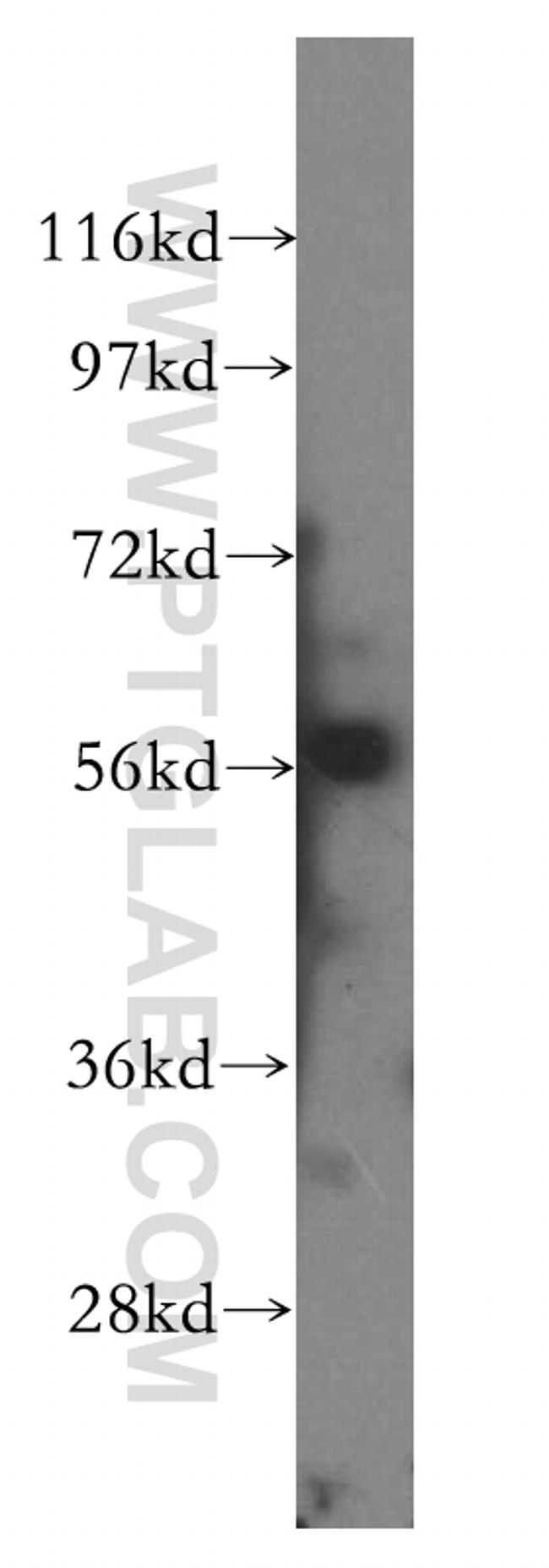 CD127/IL7R Antibody in Western Blot (WB)