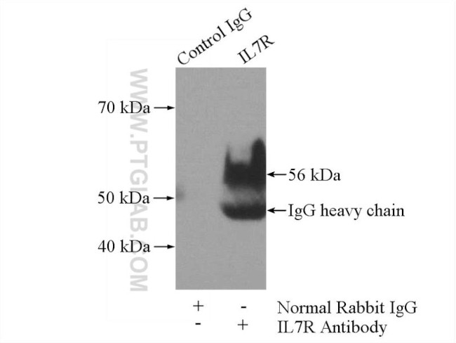 CD127/IL7R Antibody in Immunoprecipitation (IP)