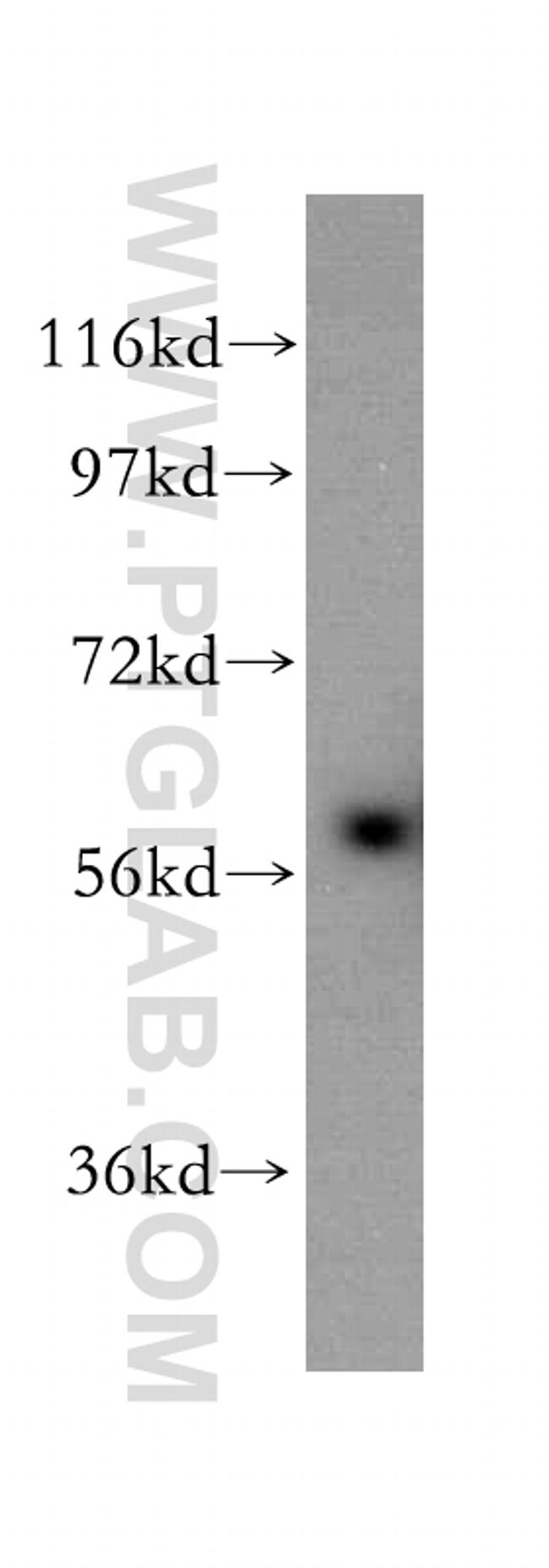 CD127/IL7R Antibody in Western Blot (WB)