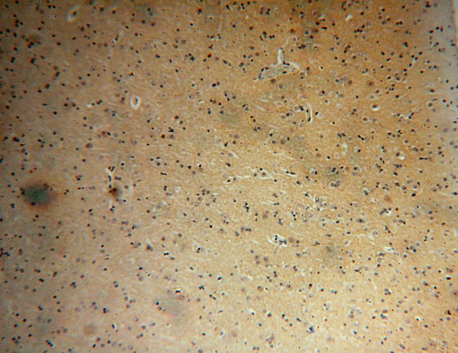 PRMT3 Antibody in Immunohistochemistry (Paraffin) (IHC (P))