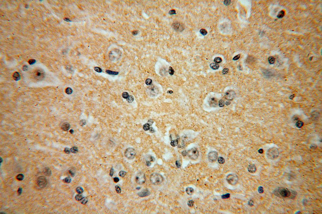 PRMT3 Antibody in Immunohistochemistry (Paraffin) (IHC (P))