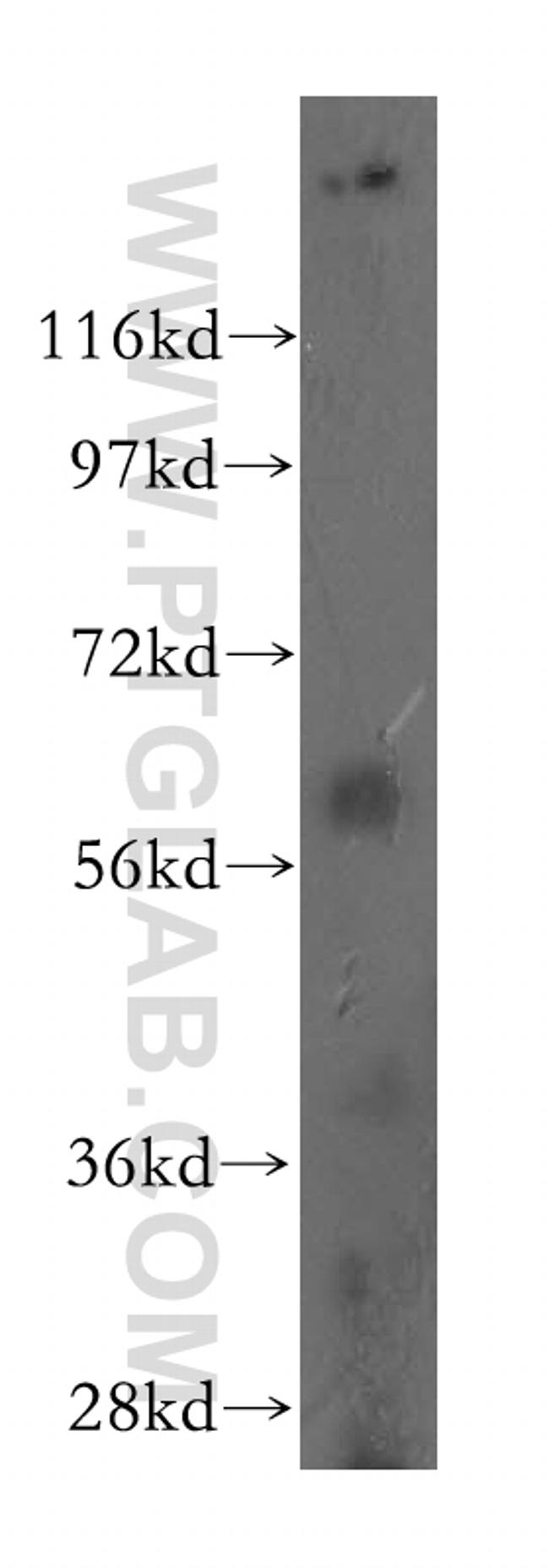 PRMT3 Antibody in Western Blot (WB)