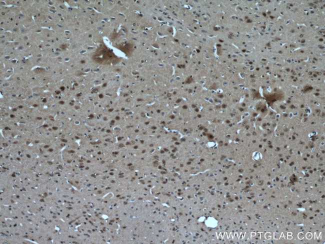 RORB Antibody in Immunohistochemistry (Paraffin) (IHC (P))