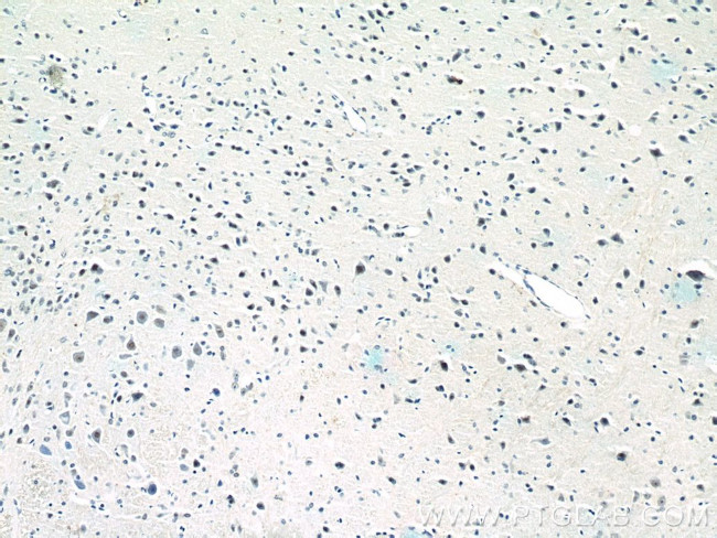 RORB Antibody in Immunohistochemistry (Paraffin) (IHC (P))