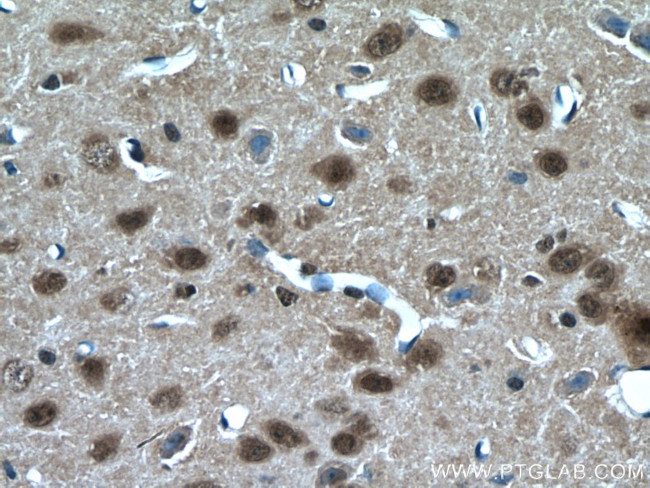 RORB Antibody in Immunohistochemistry (Paraffin) (IHC (P))