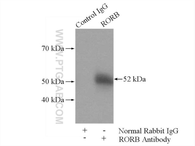 RORB Antibody in Immunoprecipitation (IP)