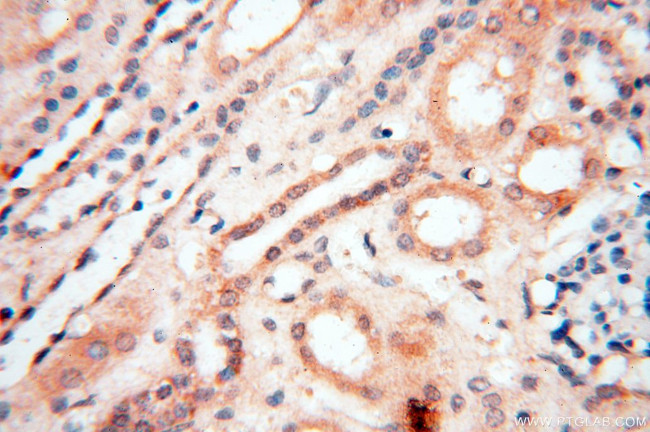 EHBP1 Antibody in Immunohistochemistry (Paraffin) (IHC (P))