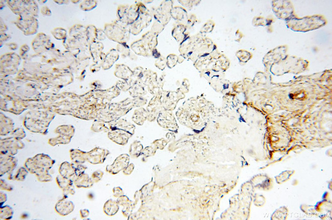 EHBP1 Antibody in Immunohistochemistry (Paraffin) (IHC (P))