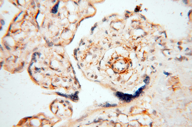 EHBP1 Antibody in Immunohistochemistry (Paraffin) (IHC (P))